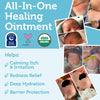 Superbalm USDA Organic Healing Ointment for Baby Eczema & Cradle Cap - 2oz