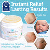 Superbalm USDA Organic Healing Ointment for Baby Eczema & Cradle Cap - 2oz